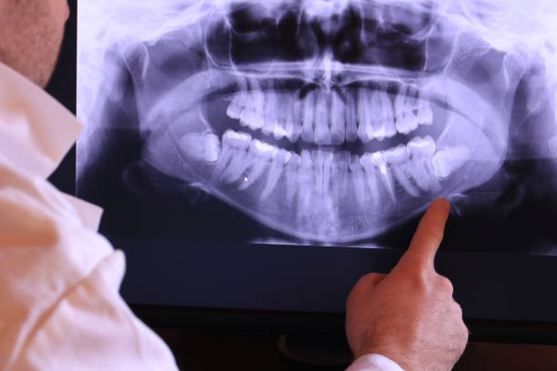 Best Emergency Treatment for Toothache in Shaw, MS