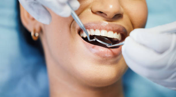 Best Emergency Tooth Extraction in Shaw, MS