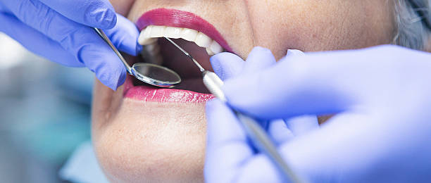 Best Walk-In Emergency Dentist in Shaw, MS